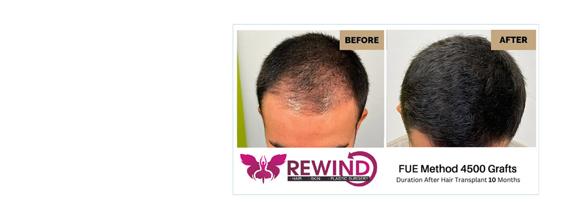 Rewind Clinic